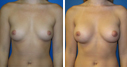 Before & After Photos